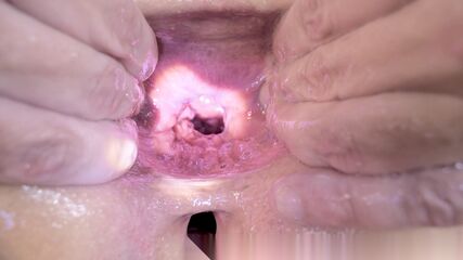 Extreme MILF Ass Tunnel